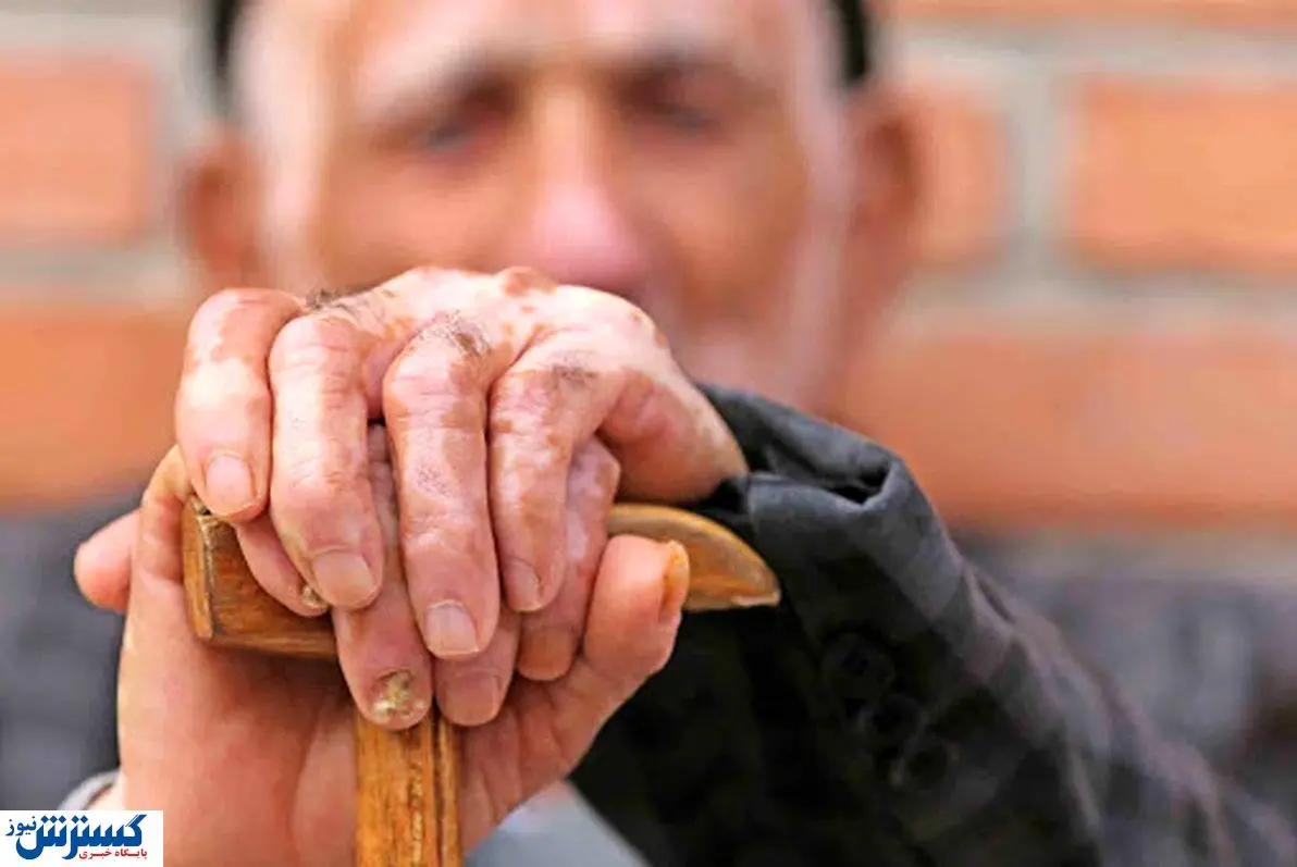 بسته‌های جدید بیمه تکمیلی؛ بازنشستگان چطور می‌توانند از مزایای کامل بهره‌مند شوند؟